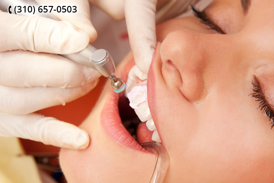 A Cosmetic Dentist in Los Angeles Can Help You with Your Gums