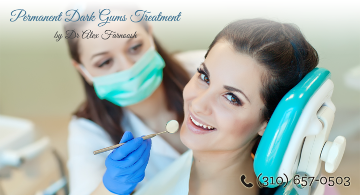 Permanent Gum Lightening To Change Your Look | Dark Gum Treatment In ...