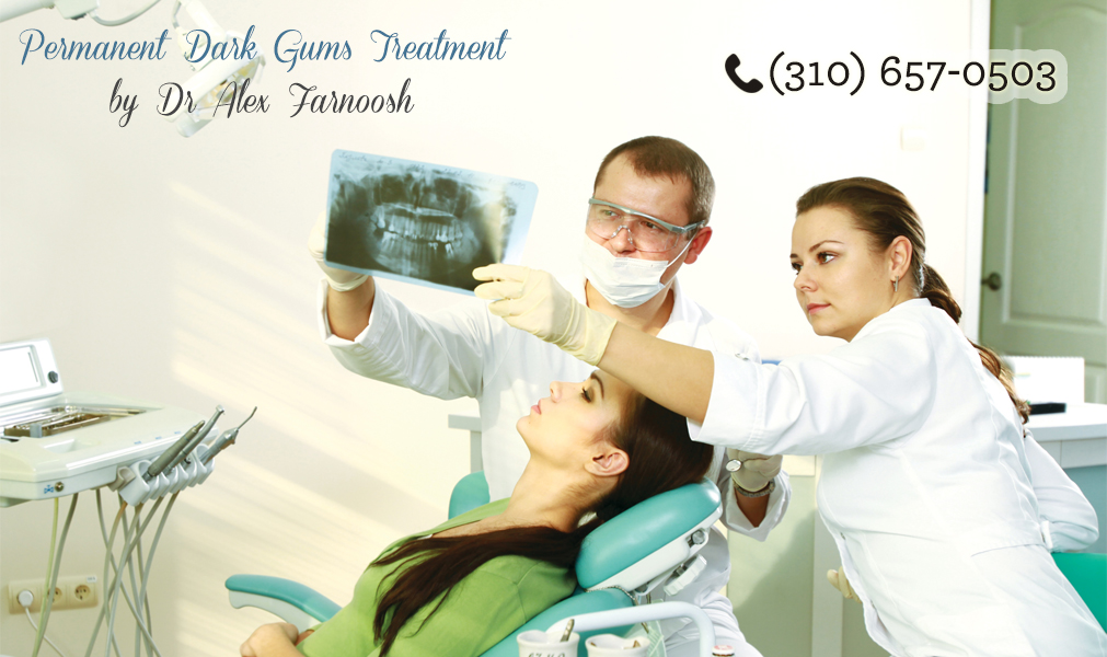 Know About Treatment for Dark Gums in Los Angeles