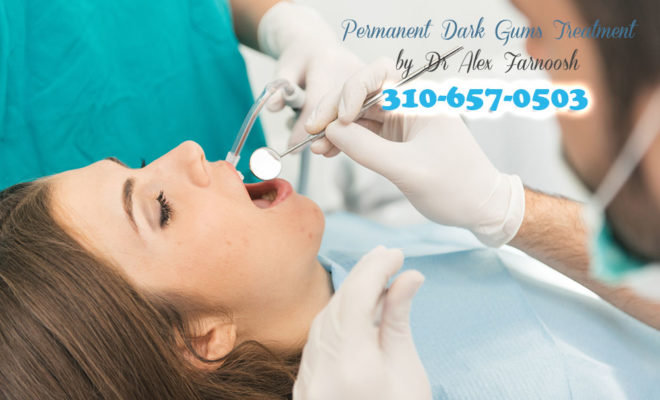 Let Your Smile Shine With Gum Whitening In Los Angeles | Dark Gum ...