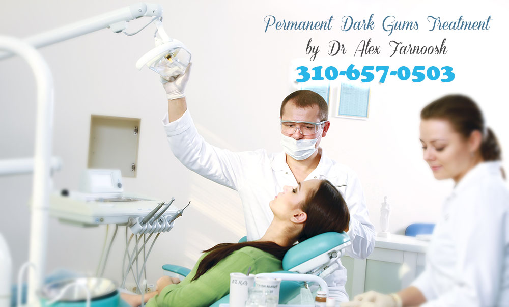 The Treatment for Dark Gums in Los Angeles That Works the Best