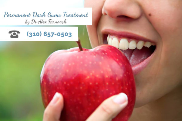 How Gum Whitening in Los Angeles Can Change Your Life