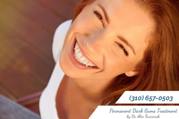 You Want a Permanent Treatment for Dark Gums in Los Angeles